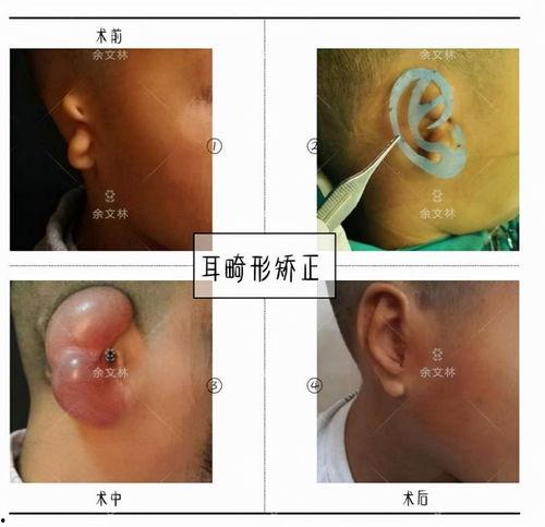 气胸可以吃土耳齐瓜吗-第3张图片-网曝911黑料热点事件 气胸可以吃土耳齐瓜吗-第3张图片-网曝911黑料热点事件